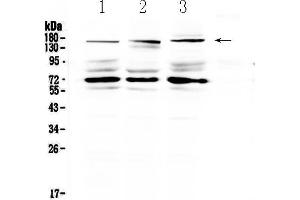Western blot analysis of IL17RA using anti-IL17RA antibody . (IL17RA antibody  (AA 53-284))