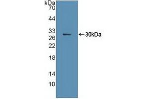 Western blot analysis of recombinant Human Ki67P. (Ki-67 antibody  (AA 3088-3235))