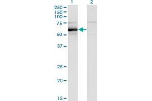 Western Blot analysis of HCK expression in transfected 293T cell line by HCK monoclonal antibody (M01), clone 1D9-1A9. (HCK antibody  (AA 1-505))
