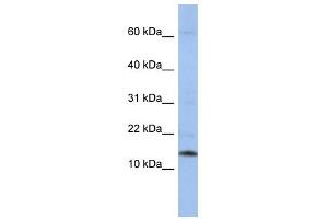 SNRPD2 antibody used at 1 ug/ml to detect target protein. (SNRPD2 antibody  (Middle Region))