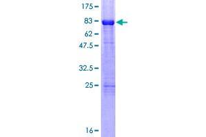 Retinoic Acid Receptor beta Protein (AA 1-448) (GST tag)