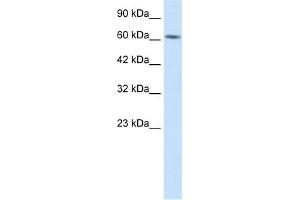 WB Suggested Anti-BTBD5 Antibody Titration:  1. (KLHL28 antibody  (Middle Region))