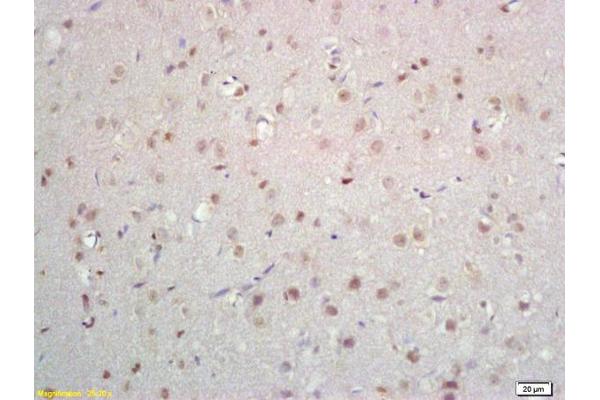 Znf423 antibody  (AA 901-1000)