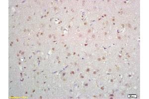 Formalin-fixed and paraffin embedded rat brain labeled with Anti-ZNF423/OAZ Polyclonal Antibody, Unconjugated (ABIN1385826) at 1:200 followed by conjugation to the secondary antibody and DAB staining (Znf423 antibody  (AA 901-1000))