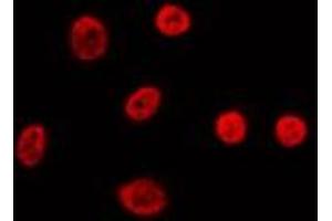 ABIN6274011 staining Hela by IF/ICC. (FUBP1 antibody  (C-Term))