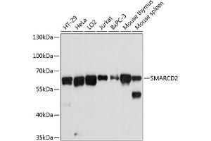 Western Blotting (WB) image for anti-SWI/SNF Related, Matrix Associated, Actin Dependent Regulator of Chromatin, Subfamily D, Member 2 (SMARCD2) (AA 454-531) antibody (ABIN6148113)