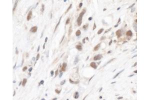 Immunohistochemistry (IHC) image for anti-Ribosomal Protein L5 (RPL5) (AA 247-297) antibody (ABIN7454984) (RPL5 antibody  (AA 247-297))