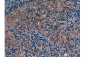Detection of SELP in Rat Ovary Tissue using Polyclonal Antibody to P-Selectin (SELP)