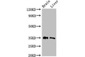 Western Blot Positive WB detected in: Mouse brain tissue, Rat liver tissue All lanes: PTF1A antibody at 2. (PTF1A antibody  (AA 224-325))