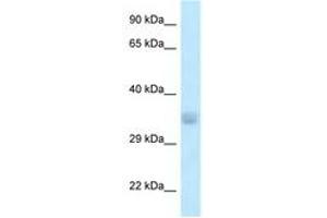 Image no. 1 for anti-Acyl-CoA Thioesterase 8 (ACOT8) (N-Term) antibody (ABIN6747608) (ACOT8 antibody  (N-Term))