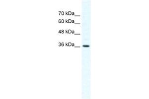 Western Blotting (WB) image for anti-Dishevelled Segment Polarity Protein 1 (DVL1) antibody (ABIN2460375) (DVL1 antibody)