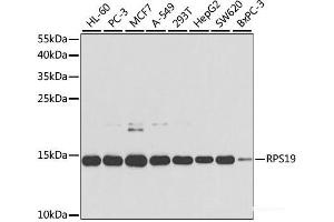 Western blot analysis of extracts of various cell lines using RPS19 Polyclonal Antibody at dilution of 1:1000. (RPS19 antibody)