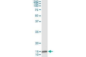 Immunoprecipitation of IL8 transfected lysate using anti-IL8 monoclonal antibody and Protein A Magnetic Bead , and immunoblotted with IL8 MaxPab rabbit polyclonal antibody. (IL-8 antibody  (AA 21-99))