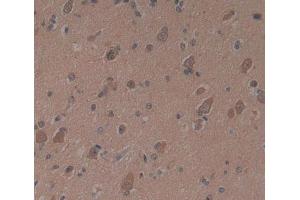Used in DAB staining on fromalin fixed paraffin- embedded brain tissue (PSMB9 antibody)