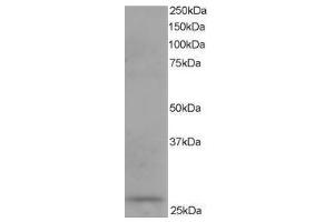 Image no. 1 for anti-Dicarbonyl/L-Xylulose Reductase (DCXR) (C-Term) antibody (ABIN374240) (DCXR antibody  (C-Term))