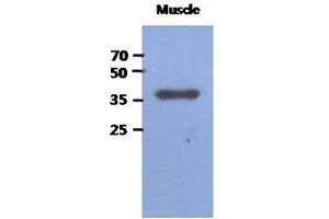 Image no. 1 for anti-Fructose-1,6-Bisphosphatase 2 (FBP2) (AA 1-339), (N-Term) antibody (ABIN1449408) (FBP2 antibody  (N-Term))