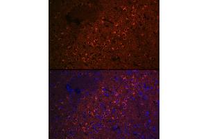 Immunofluorescence analysis of rat brain cells using CEND1 Rabbit mAb (ABIN7266242) at dilution of 1:100 (40x lens). (CEND1 antibody)