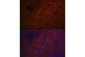 Immunofluorescence analysis of rat brain cells using CEND1 Rabbit mAb (ABIN7266242) at dilution of 1:100 (40x lens).