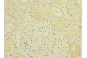 Immunohistochemistry of paraffin-embedded human kidney tissue using ABIN7163708 at dilution of 1:100 (Plexin B2 antibody  (AA 1080-1200))