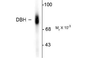 Western blots of human adrenal medulla lysate showing specific immunolabeling of the ~75k DBH protein. (DBH antibody  (C-Term))