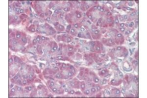 Human Pancreas (formalin-fixed, paraffin-embedded) stained with RBP1followed by biotinylated anti-goat IgG secondary antibody, alkaline phosphatase-streptavidin and chromogen. (RBP1 antibody  (C-Term))