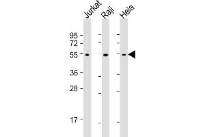 All lanes : Anti-XI Antibody at 1:1000-1:4000 dilution Lane 1: Jurkat whole cell lysates Lane 2: Raji whole cell lysates Lane 3: Hela whole cell lysates Lysates/proteins at 20 μg per lane. (XIAP antibody)