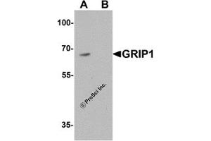 Western Blotting (WB) image for anti-Glutamate Receptor Interacting Protein 1 (GRIP1) (C-Term) antibody (ABIN1077440) (GRIP1 antibody  (C-Term))