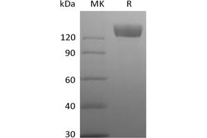 Western Blotting (WB) image for Angiotensin I Converting Enzyme 2 (ACE2) (Active) protein (Fc Tag) (ABIN7321044) (ACE2 Protein (Fc Tag))
