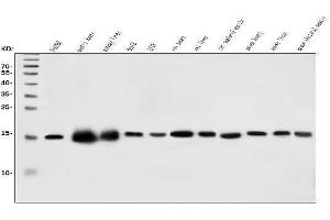 Western blot analysis of CHCHD10 using anti-CHCHD10 antibody (ABIN7602507). (CHCHD10 antibody  (AA 80-142))
