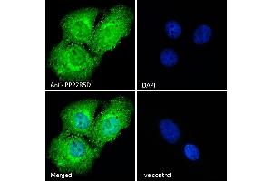 (ABIN184648) Immunofluorescence analysis of paraformaldehyde fixed U2OS cells, permeabilized with 0. (PPP2R5D antibody  (C-Term))