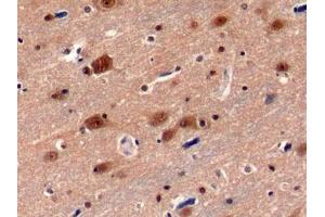 Detection of PSMC3 in Human Cerebrum Tissue using Polyclonal Antibody to Proteasome 26S Subunit, ATPase 3 (PSMC3) (PSMC3 antibody  (AA 2-439))