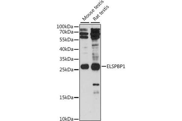 ELSPBP1 antibody  (AA 110-223)