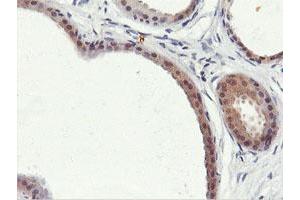 Immunohistochemical staining of paraffin-embedded Human breast tissue using anti-PNPO mouse monoclonal antibody. (PNPO antibody)