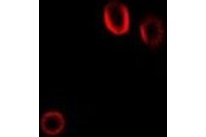 Immunofluorescent analysis of Colipase staining in Hela cells. (CLPS antibody)