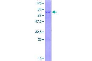 FDPS Protein (AA 1-419) (GST tag)