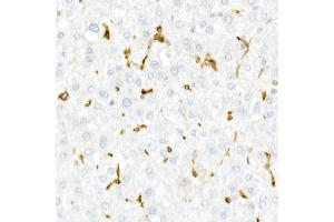 Immunohistochemistry of paraffin-embedded Human liver using CD74 antibody (ABIN6128421, ABIN6138228, ABIN6138230 and ABIN6221316) at dilution of 1:25 (40x lens).