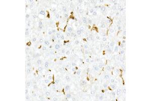 Immunohistochemistry of paraffin-embedded Human liver using CD74 antibody (ABIN6128421, ABIN6138228, ABIN6138230 and ABIN6221316) at dilution of 1:25 (40x lens). (CD74 antibody  (AA 73-232))