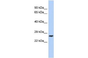 WB Suggested Anti-DIRAS1 Antibody Titration: 0. (DIRAS1 antibody  (Middle Region))