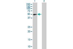 Western Blot analysis of RNF146 expression in transfected 293T cell line by RNF146 MaxPab polyclonal antibody. (RNF146 antibody  (AA 1-358))