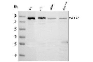 Western blot analysis of INPPL1 using anti-INPPL1 antibody (ABIN6719492). (INPPL1 antibody  (AA 1172-1258))