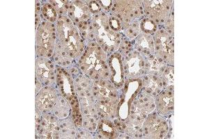 Immunohistochemical staining of human kidney with ZNF75A polyclonal antibody  shows moderate cytoplasmic and nuclear positivity in cells in tubules at 1:50-1:200 dilution. (ZNF75A antibody)
