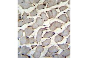 Formalin fixed and paraffin embedded human skeletal muscle reacted with DDX60L Antibody (C-term) followed by peroxidase conjugation of the secondary antibody and DAB staining. (DDX60L antibody  (C-Term))