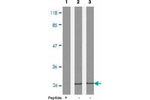 Western blot analysis of extract from HeLa cells treated with EGF (lane 1 and 2) and IFN-a (lane 3), using CDKN1B (phospho T187) polyclonal antibody . (CDKN1B antibody  (pThr187))