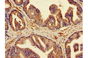 Immunohistochemistry of paraffin-embedded human prostate tissue using ABIN7145519 at dilution of 1:100 (MSMB antibody  (AA 27-107))