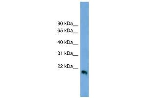 WB Suggested Anti-IFNB1 Antibody Titration:  0. (IFNB1 antibody  (Middle Region))