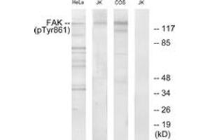 Western blot analysis of extracts from HeLa cells, Jurkat cells and COS cells, using FAK (Phospho-Tyr861) Antibody. (FAK antibody  (pTyr861))