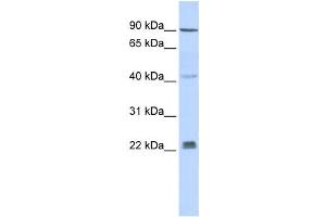 Western Blotting (WB) image for anti-Insulin Induced Gene 1 (INSIG1) antibody (ABIN2458475)