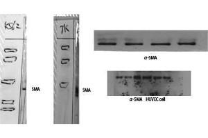 Western Blotting (WB) image for anti-alpha-SMA (N-Term) antibody (ABIN3180968) (alpha-SMA (N-Term) antibody)