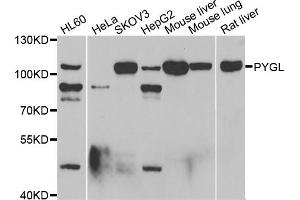 Western blot analysis of extracts of various cell lines, using PYGL antibody (ABIN5974053) at 1/1000 dilution. (PYGL antibody)