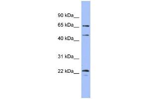 WB Suggested Anti-MAPK4 Antibody Titration: 0. (MAPK4 antibody  (Middle Region))